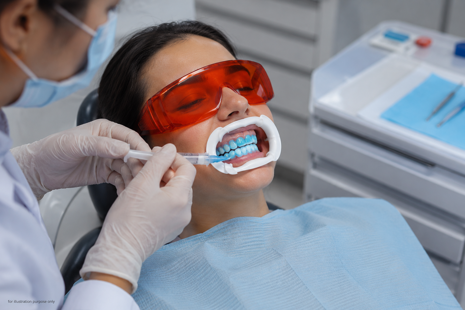 Teeth whitening
